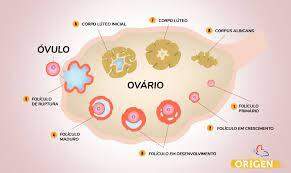 Diagnóstico de Endometriose