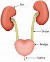 Tratamento Cirúrgico para Endometriose