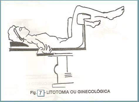 Cirurgia Vaginal