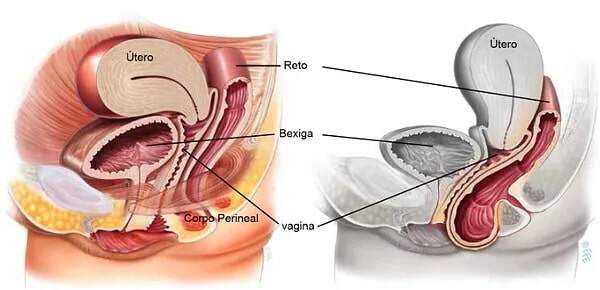 Prolapso genital