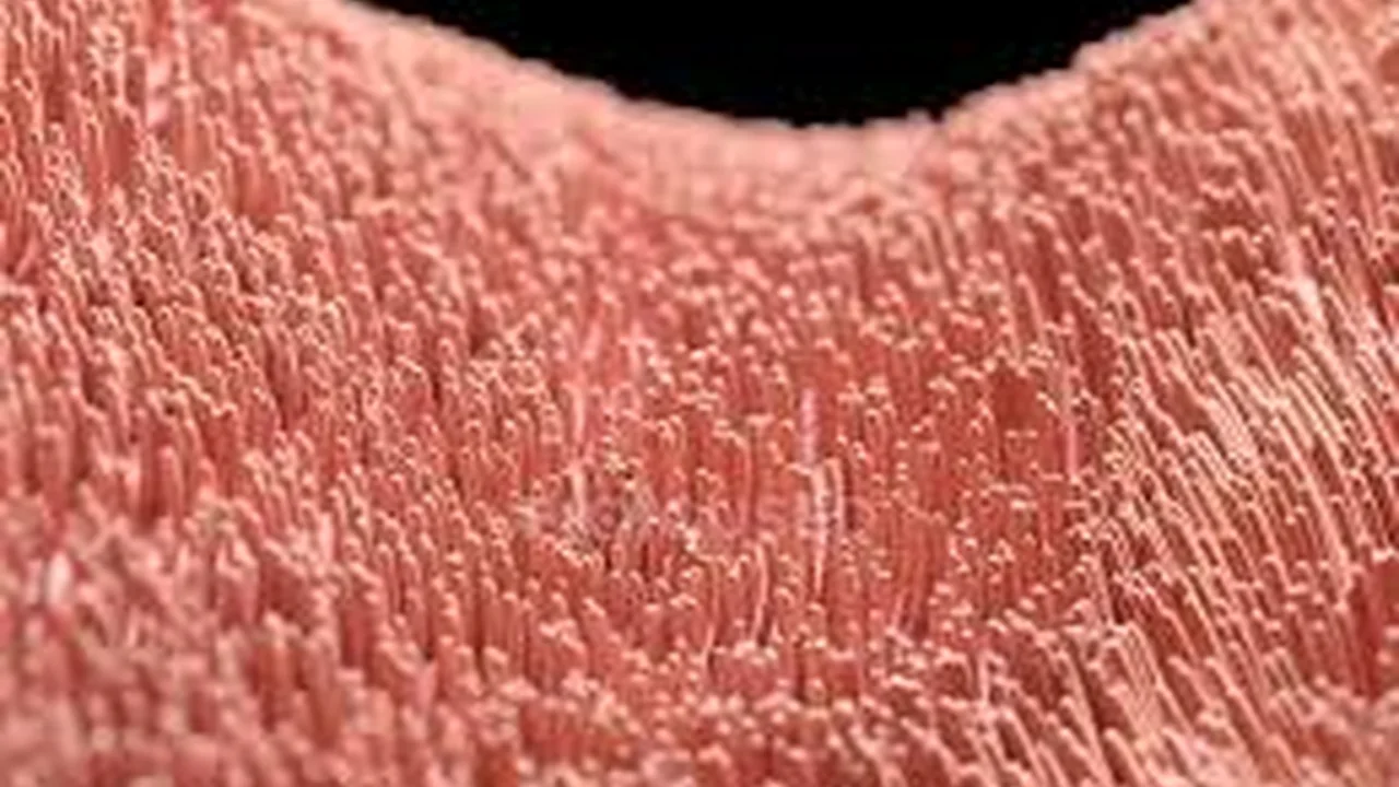 Ampliação de cílios tubários, uma das estruturas envolvidas em como a endometriose causa infertilidade.